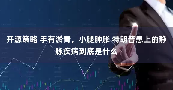 开源策略 手有淤青，小腿肿胀 特朗普患上的静脉疾病到底是什么
